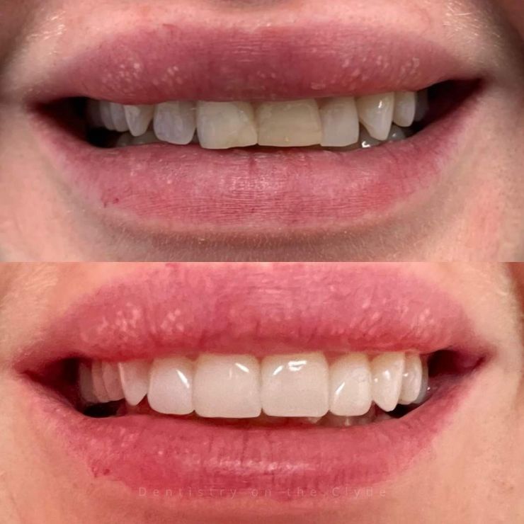Transforming Smiles