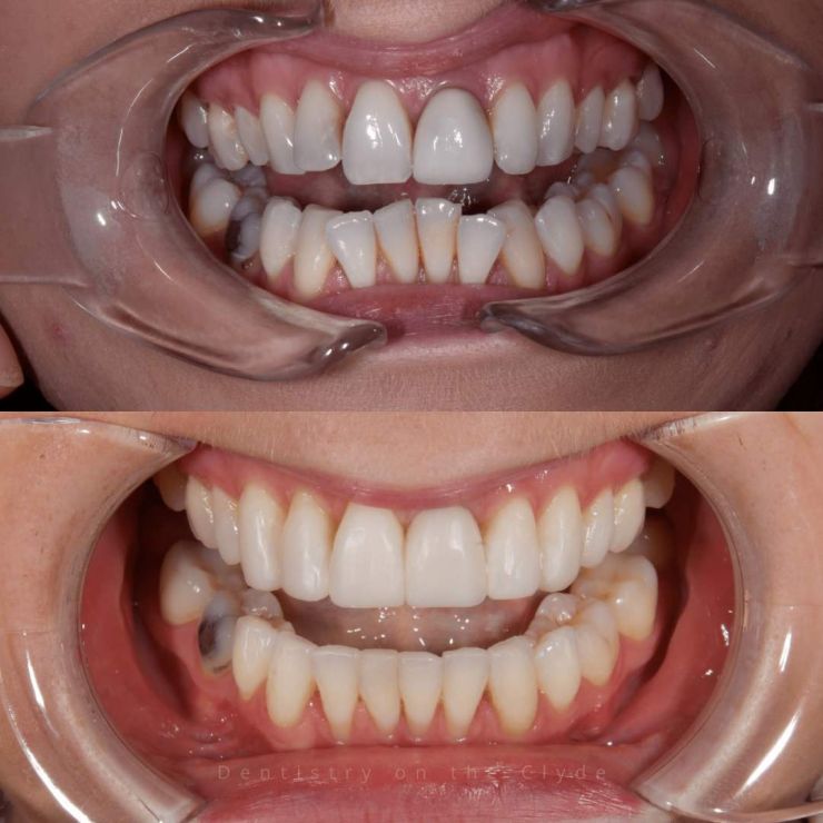 Dentistry On The Clyde | Smile Gallery