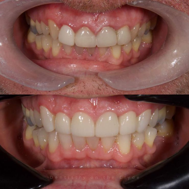 Transforming Smiles