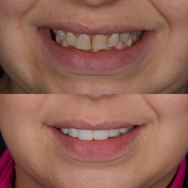 Dentistry On The Clyde | Smile Gallery
