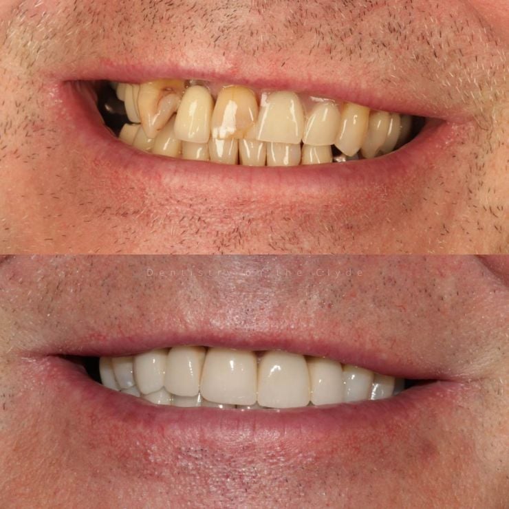 Dentistry On The Clyde | Smile Gallery