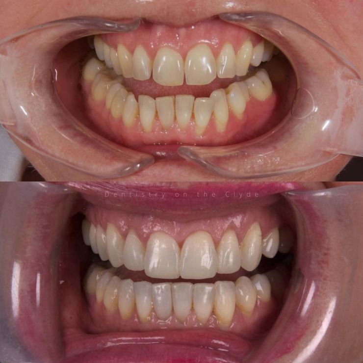 Dentistry On The Clyde | Smile Gallery