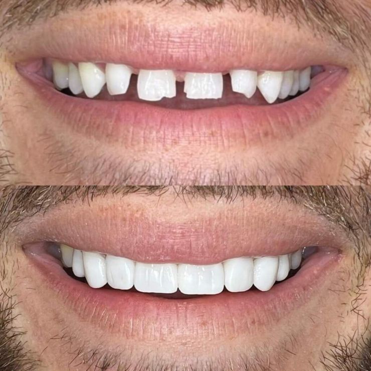 Transforming Smiles
