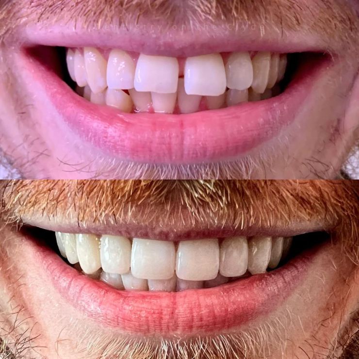 Dentistry On The Clyde | Smile Gallery