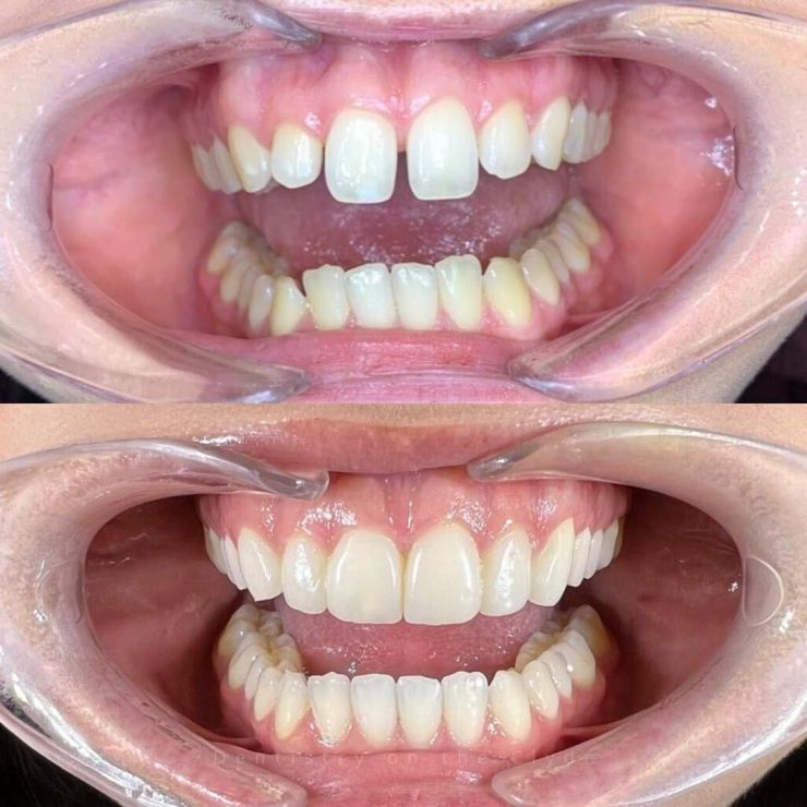 Transforming Smiles