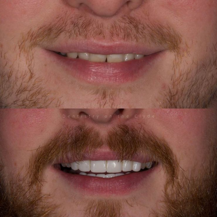 Dentistry On The Clyde | Smile Gallery
