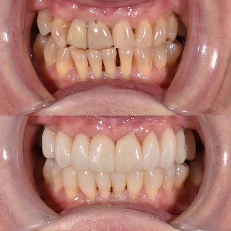 Dentistry On The Clyde | Smile Gallery
