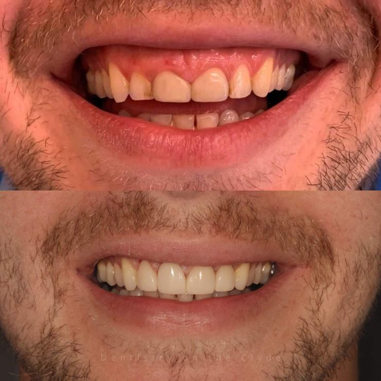Transforming Smiles