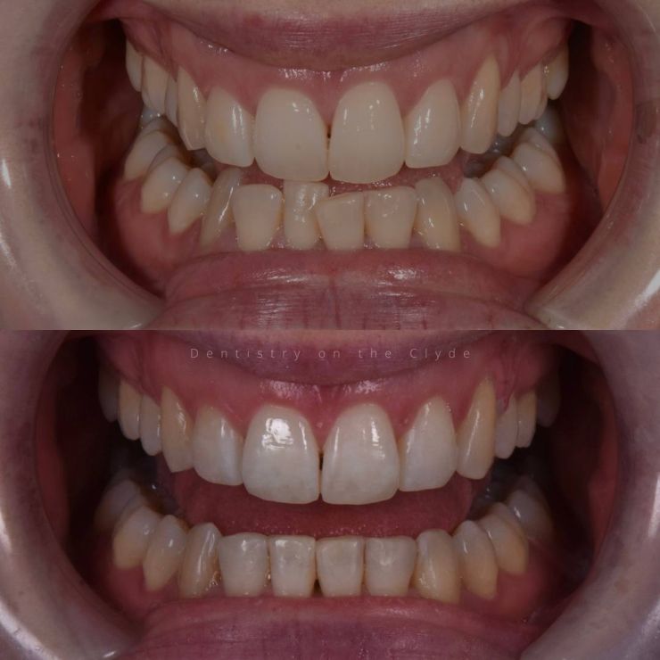 Dentistry On The Clyde | Smile Gallery