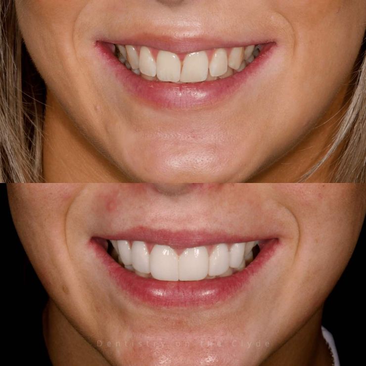 Transforming Smiles