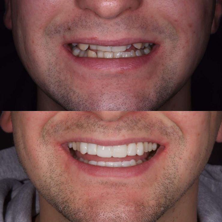Transforming Smiles