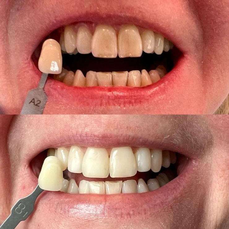 Dentistry On The Clyde | Smile Gallery