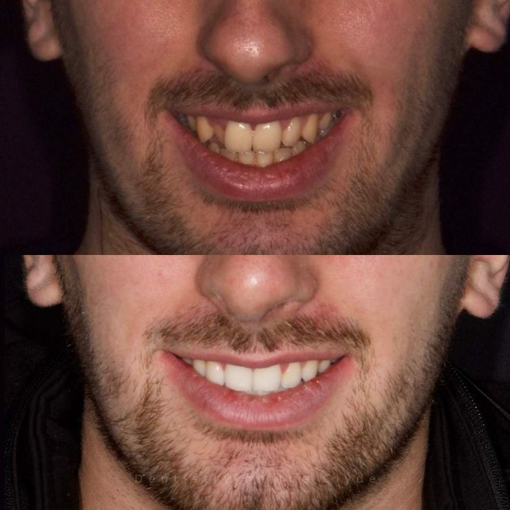 Transforming Smiles