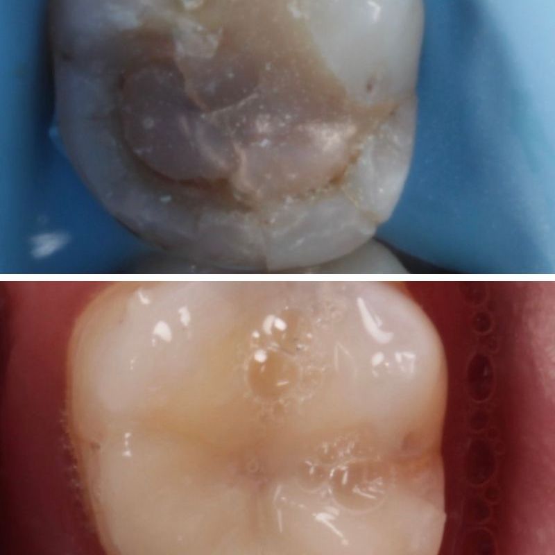Before & after treatment with Thurga