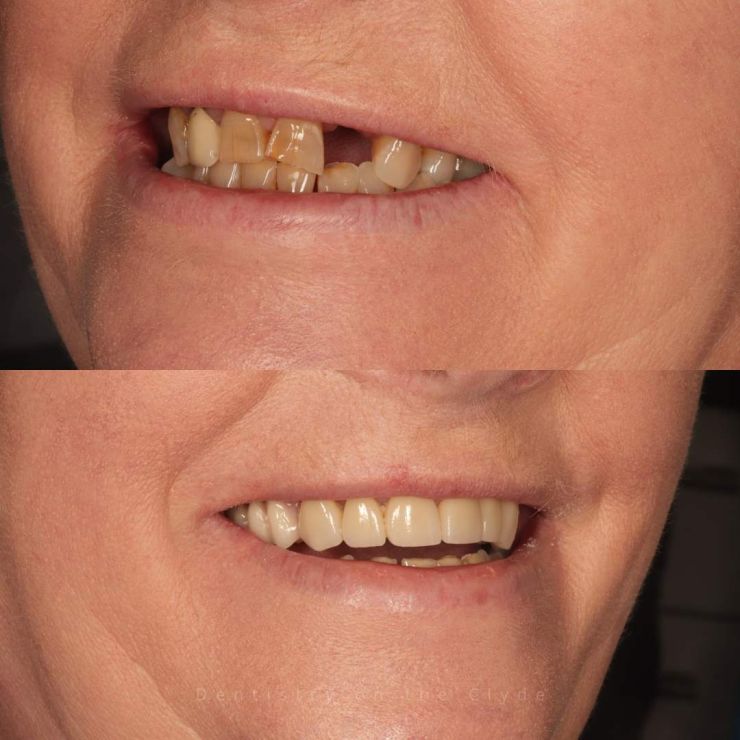 Transforming Smiles
