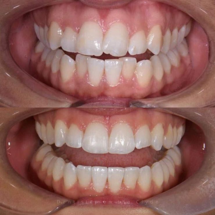 Transforming Smiles