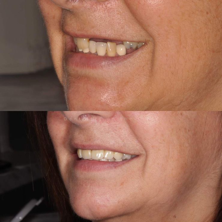 Dentistry On The Clyde | Smile Gallery