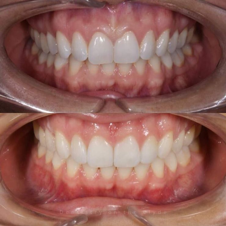 Dentistry On The Clyde | Smile Gallery