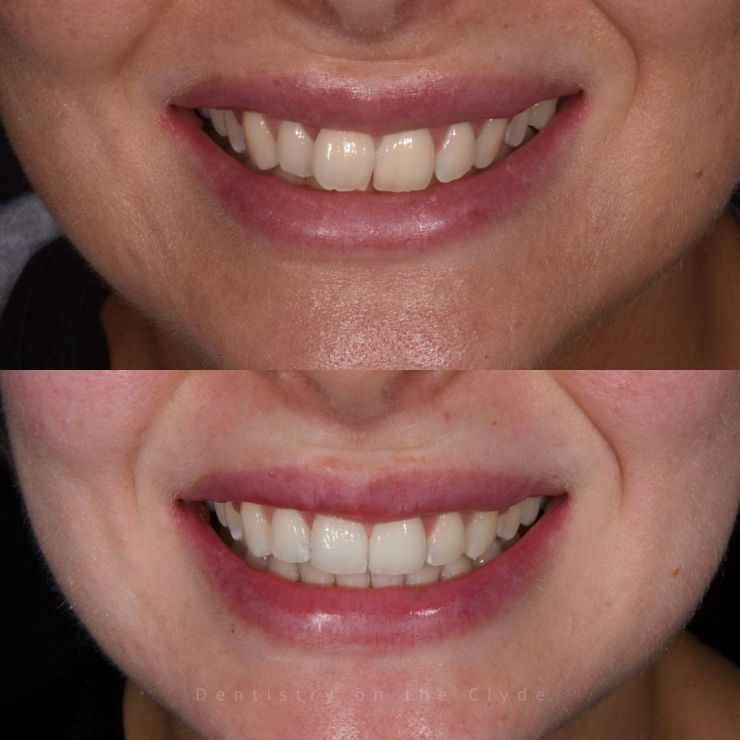 Dentistry On The Clyde | Smile Gallery