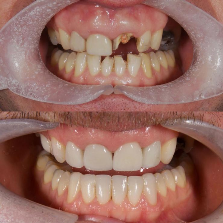 Dentistry On The Clyde | Smile Gallery