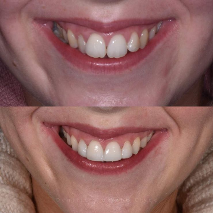 Dentistry On The Clyde | Smile Gallery