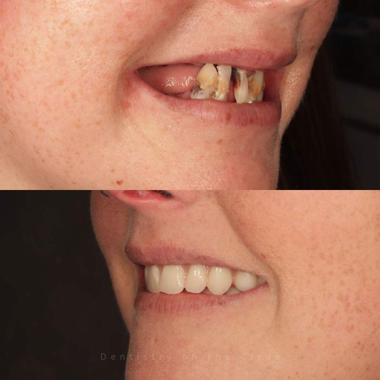 Transforming Smiles