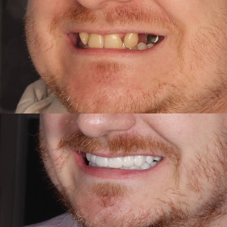 Dentistry On The Clyde | Smile Gallery