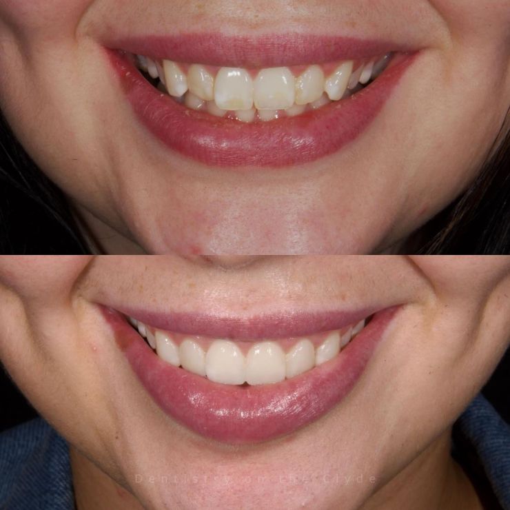 Dentistry On The Clyde | Smile Gallery